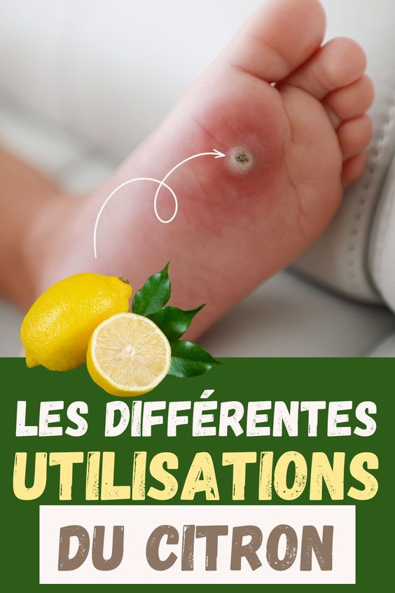 Les différentes utilisations du citron