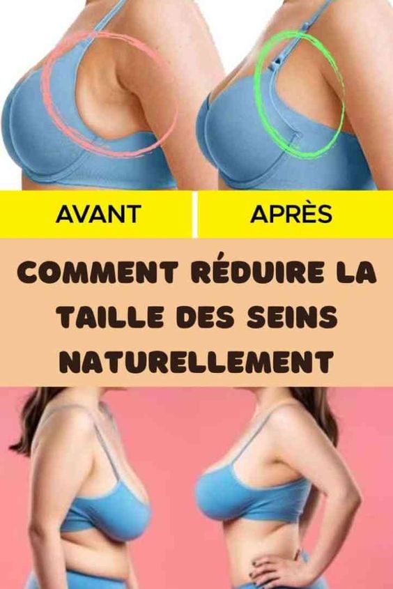 Comment réduire la taille des seins naturellement