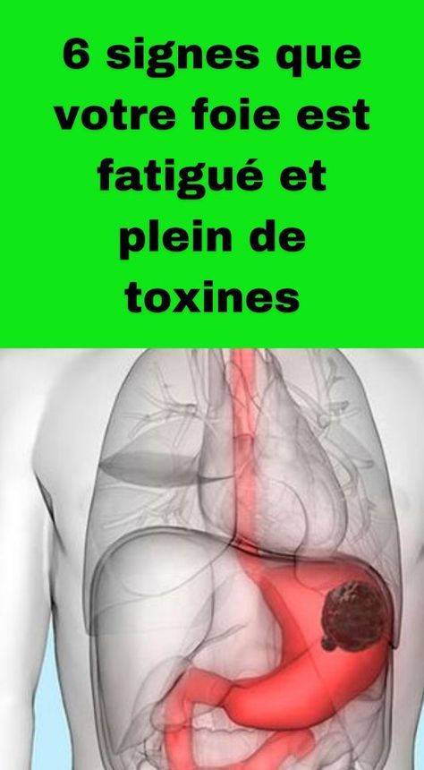 6 signes que votre foie est fatigué et plein de toxines