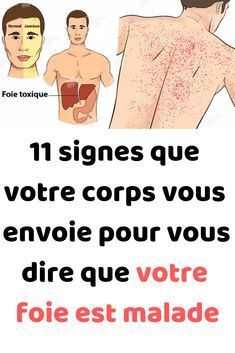 11 signes que votre corps envoie vous indiquant que votre foie est malade