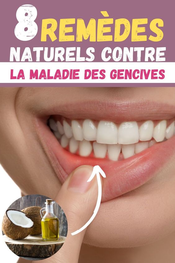 La maladie des gencives : huit remèdes naturels pour la traiter