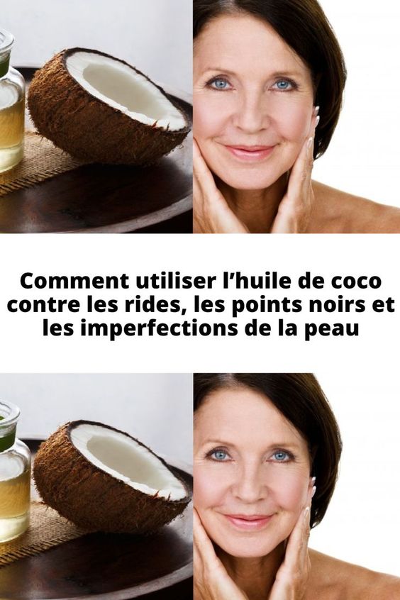 Comment utiliser l’huile de coco contre les rides, les points noirs et les imperfections de la peau