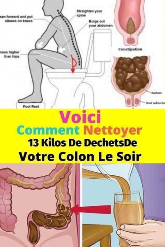 Voici comment nettoyer 5 kilos de détritus du côlon