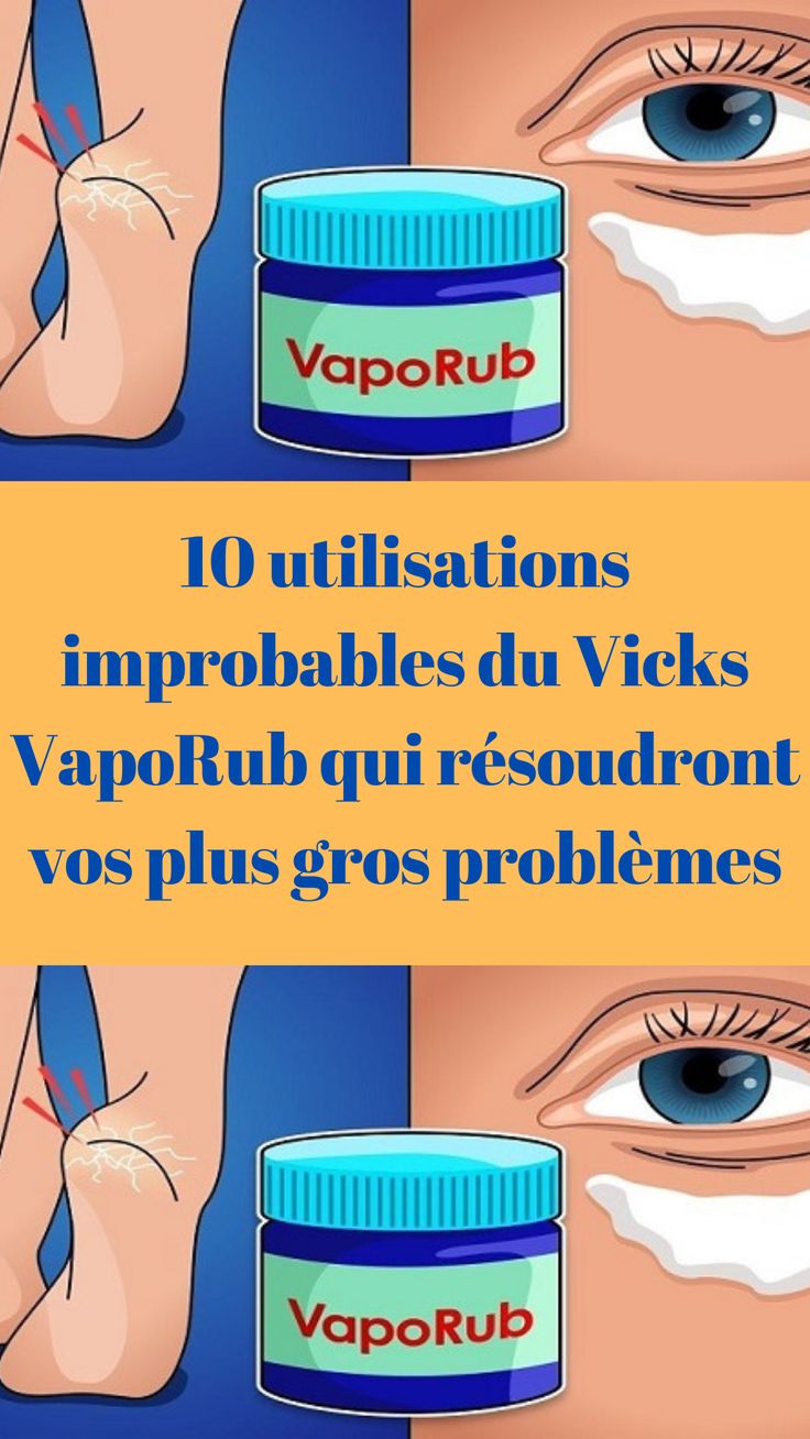 10 utilisations improbables du Vicks VapoRub qui résoudront vos plus gros problèmes