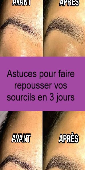 Astuces pour faire repousser vos sourcils en 3 jours