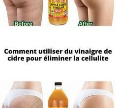 Comment utiliser du vinaigre de cidre pour éliminer la cellulite