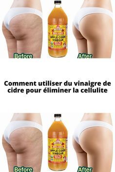 Comment utiliser du vinaigre de cidre pour éliminer la cellulite