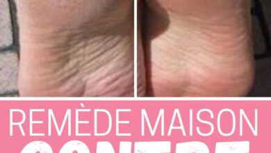 Remède miracle contre les talons secs et fissurés