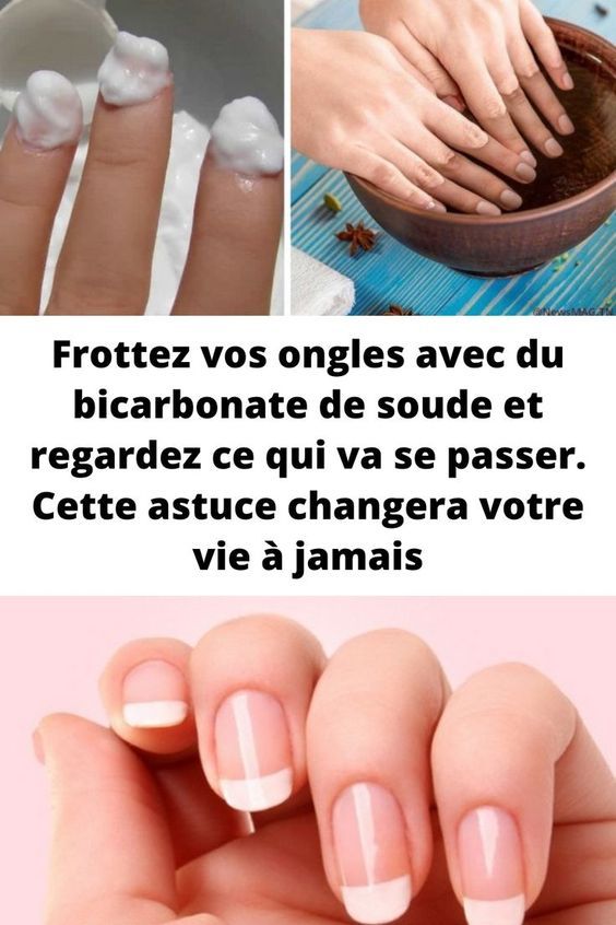 Frottez vos ongles avec du bicarbonate de soude et regardez ce qui va se passer. Cette astuce changera votre vie à jamais