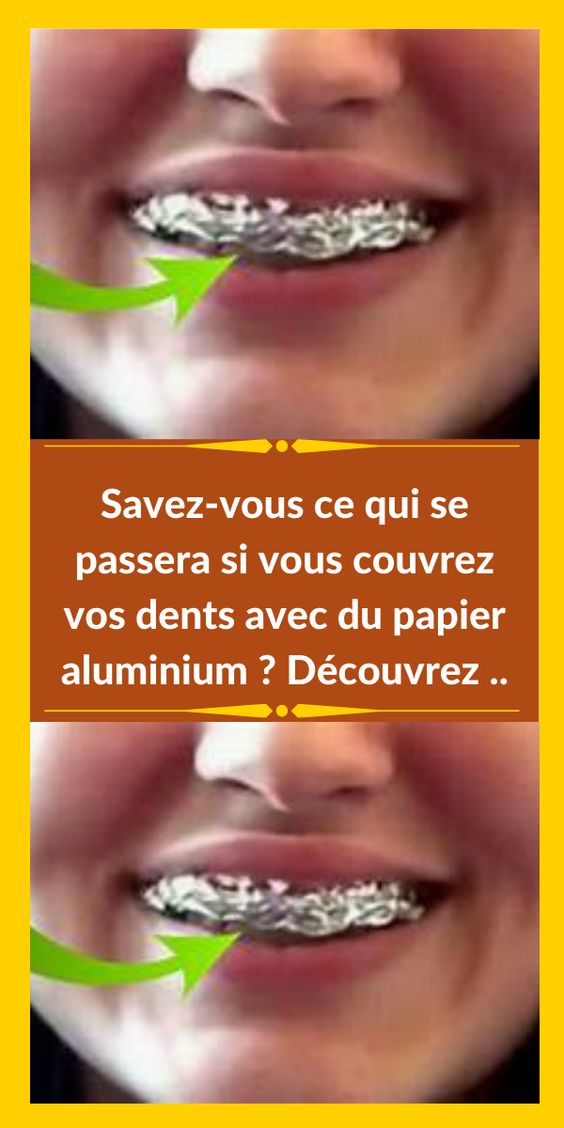 Savez-vous ce qui se passera si vous couvrez vos dents avec du papier aluminium ? Découvrez ..