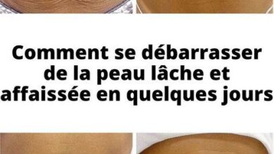 Comment se débarrasser de la peau lâche et affaissée en quelques jours