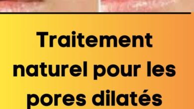 Traitement naturel pour les pores dilatés