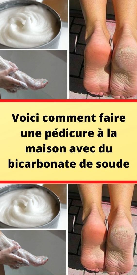 Voici comment faire une pédicure à la maison avec du bicarbonate de soude