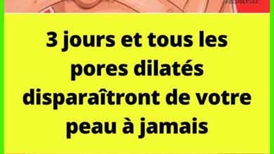 3 jours et tous les pores dilatés disparaîtront de votre peau à jamais