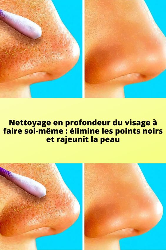 Nettoyage en profondeur du visage à faire soi-même : élimine les points noirs et rajeunit la peau