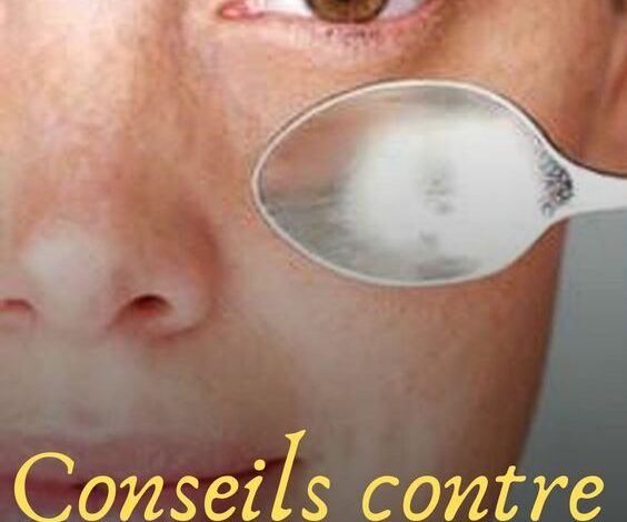 Conseils contre les cernes sous les yeux