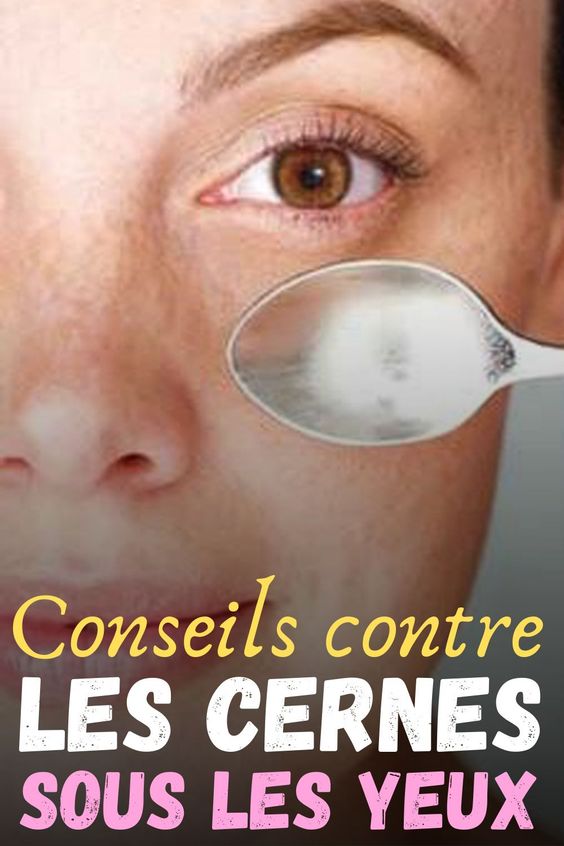 Conseils contre les cernes sous les yeux