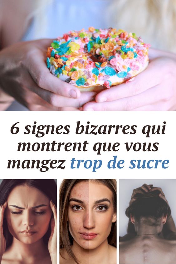 6 signes bizarres qui montrent que vous mangez trop de sucre