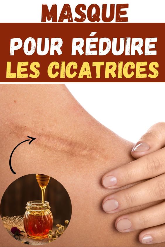 Masque pour réduire les cicatrices