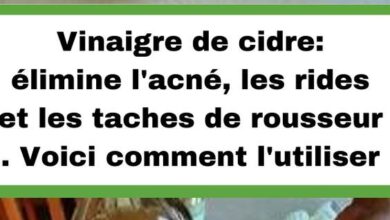 Vinaigre de cidre: élimine l’acné, les rides et les taches de rousseur . Voici comment l’utiliser