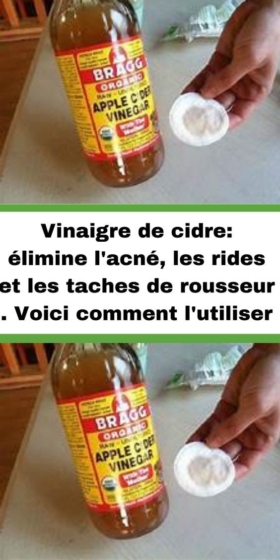 Vinaigre de cidre: élimine l’acné, les rides et les taches de rousseur . Voici comment l’utiliser