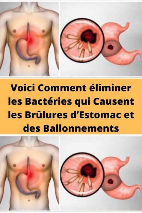 Voici Comment éliminer les Bactéries qui Causent les Brûlures d’Estomac et des Ballonnements