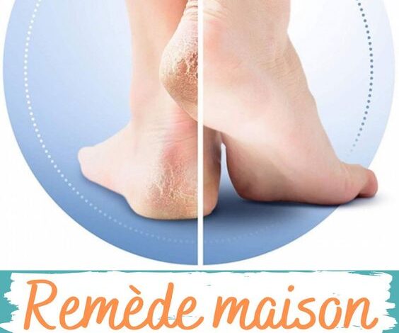 Remède maison contre les talons secs et déshydratés