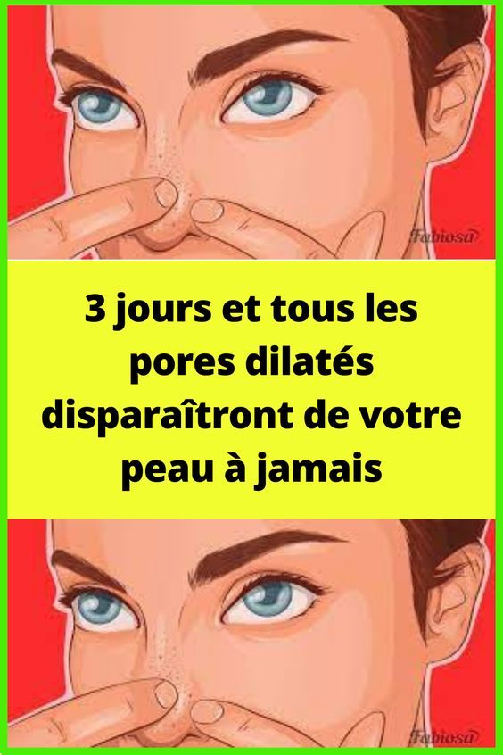 3 jours et tous les pores dilatés disparaîtront de votre peau à jamais