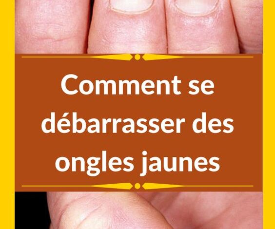 Comment se débarrasser des ongles jaunes