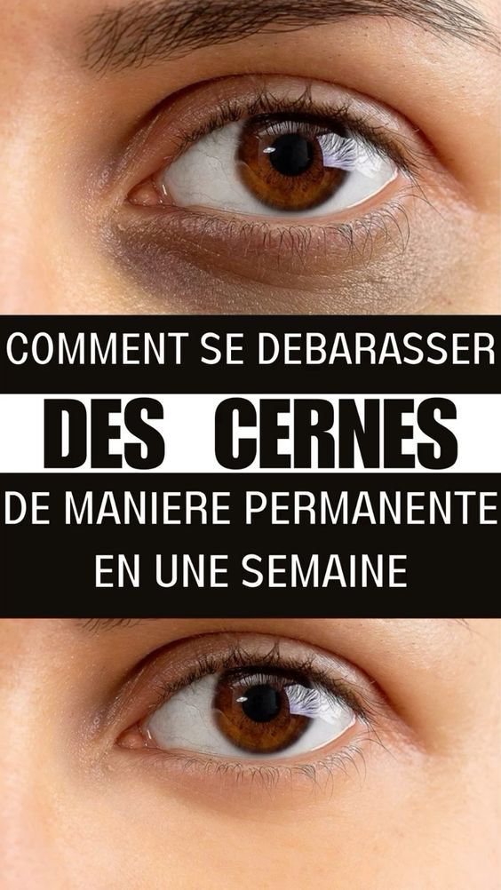 Dissimuler les Cernes : Conseils et Astuces d'Expert