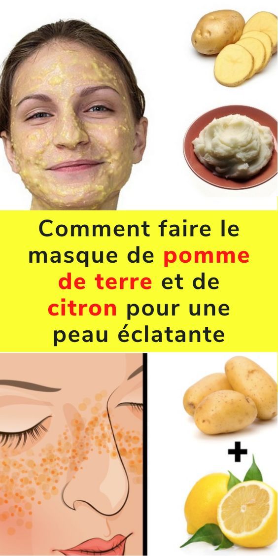 Comment faire le masque de pomme de terre et de citron pour une peau éclatante