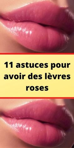 11 astuces pour avoir des lèvres roses