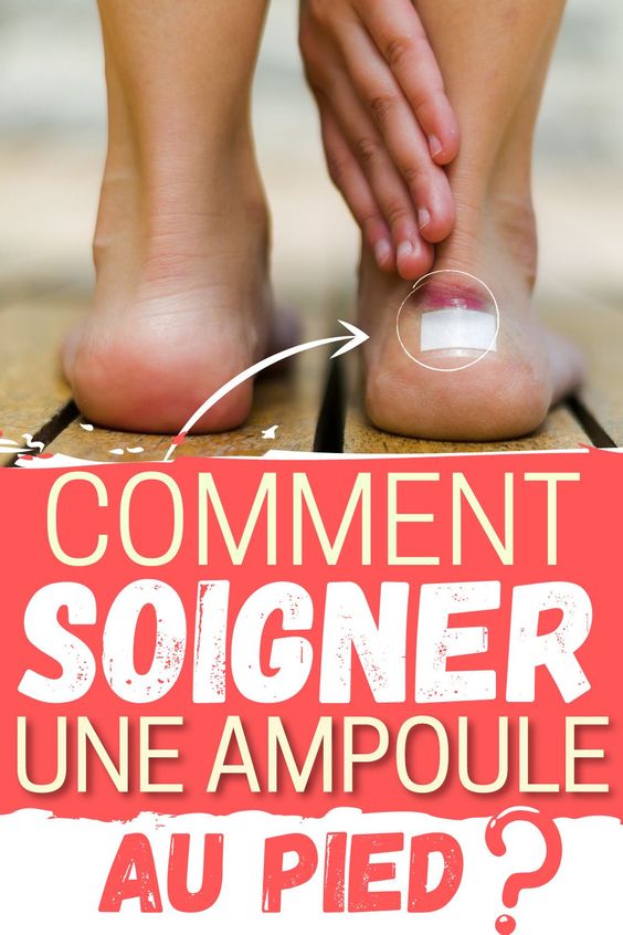 Comment soigner une ampoule au pied