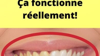 Vous en avez assez des dents jaunes? Essayez cette astuce! Ça fonctionne réellement!