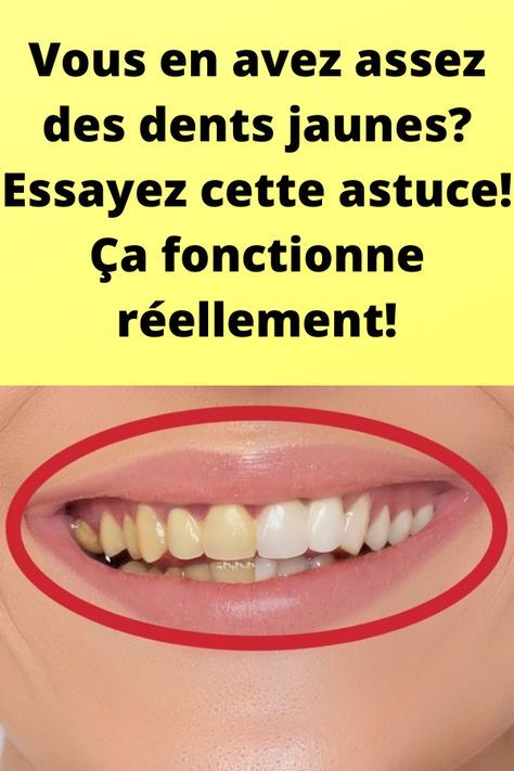 Vous en avez assez des dents jaunes? Essayez cette astuce! Ça fonctionne réellement!