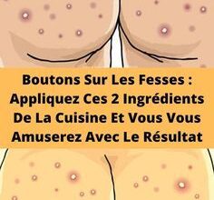 Boutons Sur Les Fesses : Appliquez Ces 2 Ingrédients De La Cuisine Et Vous Vous Amuserez Avec Le Résultat