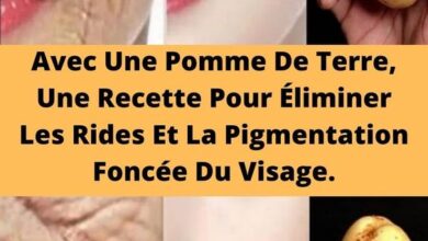 Avec Une Pomme De Terre, Une Recette Pour Éliminer Les Rides Et La Pigmentation Foncée Du Visage.