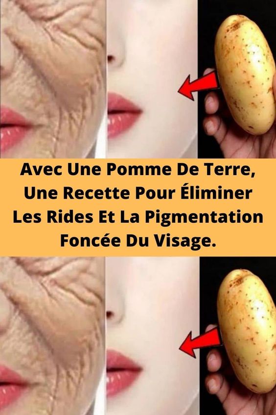 Avec Une Pomme De Terre, Une Recette Pour Éliminer Les Rides Et La Pigmentation Foncée Du Visage.